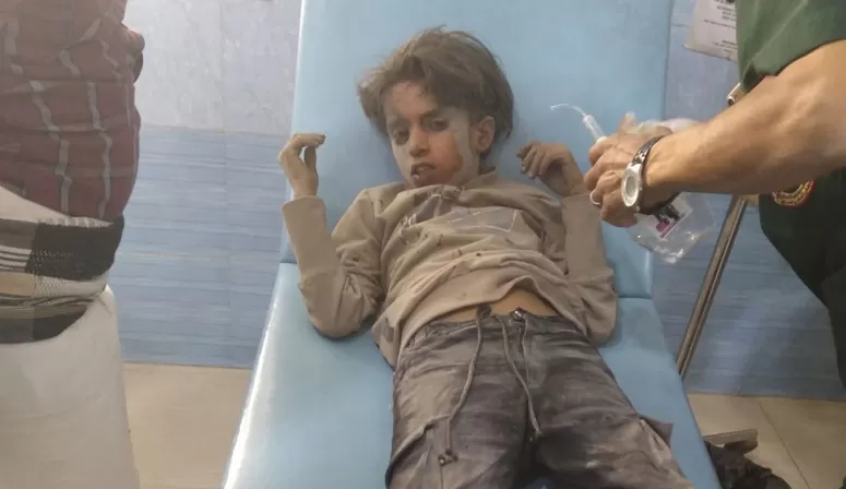 إصابة طفل وفتاة بقصف حوثي على تعز.. ومراقبون: سلوك يعكس خوفاً من أي تحرك عسكري حاسم